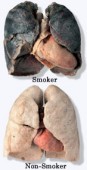 Lungs